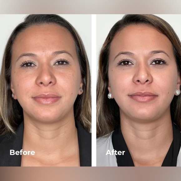 Foreo Luna 4 Smart Facial Cleansing and Firming Device - Picture 4 of 16